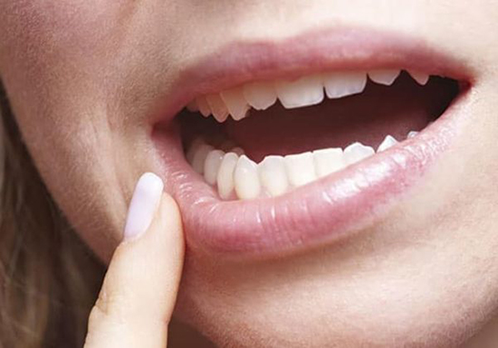 IQOS – причины, вызывающие боль в деснах и зубах. Способы решения проблемы, профилактика